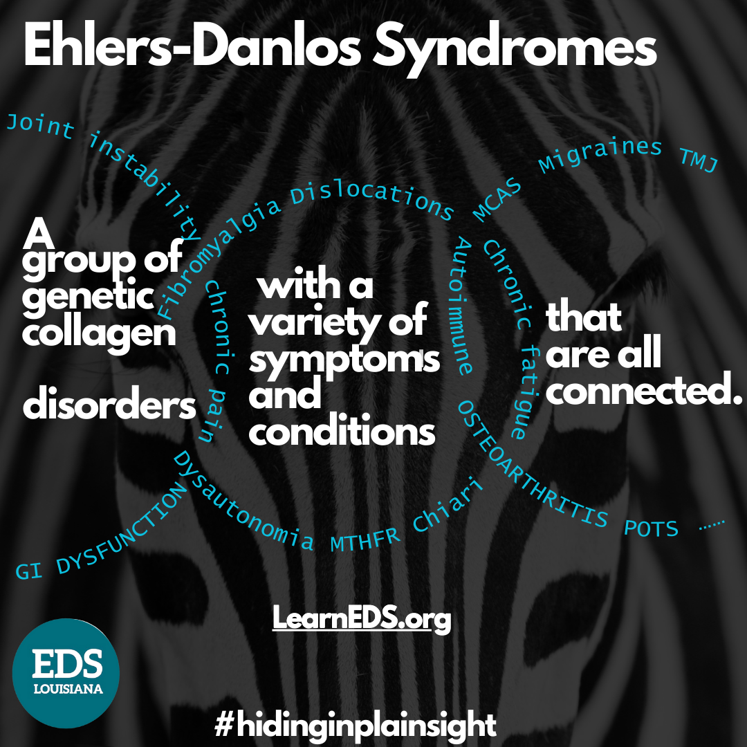 connective tissues EDS